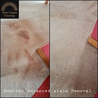 Advanced stain removal